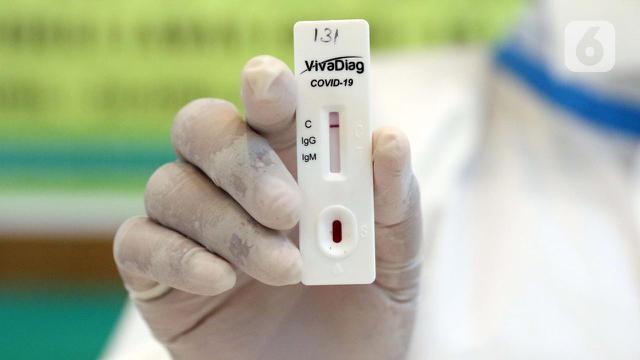 Θετικά σε κορωνοίό τα 22 από τα 556 rapid test που έγιναν τη Δευτέρα δωρεάν σε Βέροια, Νάουσα, Αλεξάνδρεια