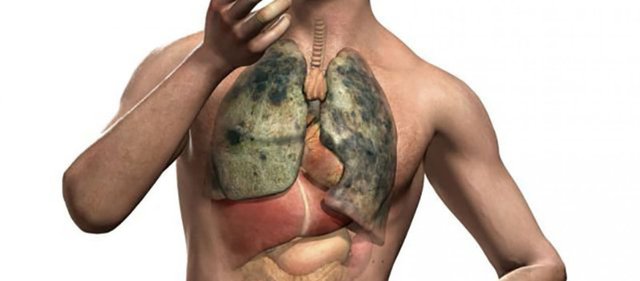 Αυτά είναι τα σημάδια που δείχνουν πιθανό καρκίνο του πνεύμονα!