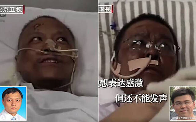 Γιατροί στην Κίνα έδωσαν μάχη με τον κορονοϊό και ξύπνησαν από κώμα με σκούρο δέρμα